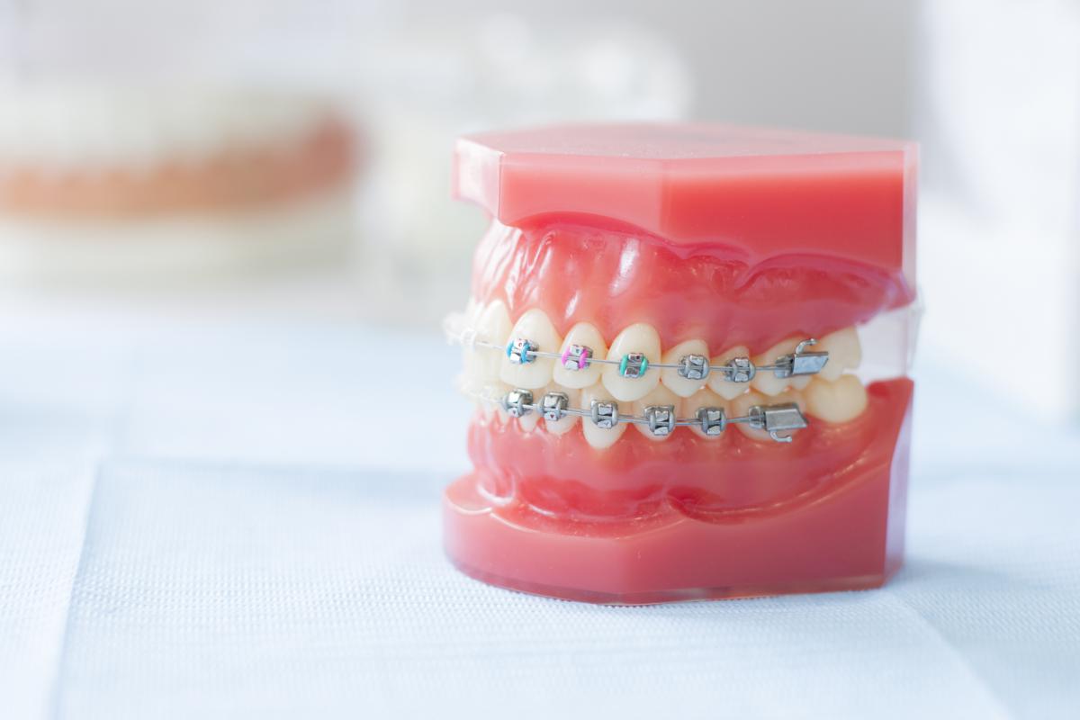 brakets
